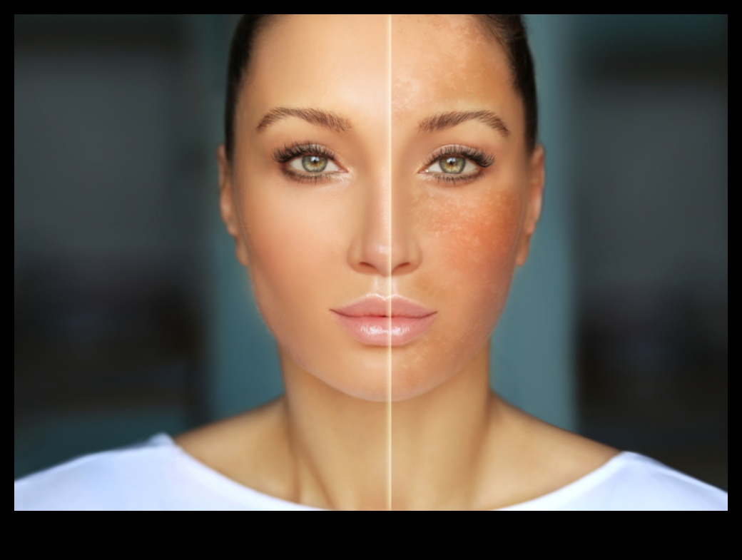 تأثير التلوث على بشرتك: الحماية من الضغوطات البيئية